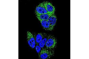 Confocal immunofluorescent analysis of HNF4A Antibody (N-term) (ABIN653385 and ABIN2842849) with MCF-7 cell followed by Alexa Fluor 488-conjugated goat anti-rabbit lgG (green). (HNF4A 抗体  (N-Term))