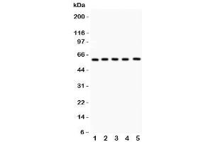 Western blot testing of LRH-1 antibody and Lane 1:  PANC (P2RX5 抗体  (AA 44-237))