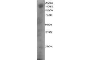 ABIN184630 staining (4µg/ml) of A431 lysate (RIPA buffer, 35µg total protein per lane). (DOCK1 抗体  (C-Term))