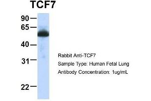 Host:  Rabbit  Target Name:  TCF7  Sample Type:  Human Fetal Lung  Antibody Dilution:  1. (TCF7 抗体  (Middle Region))