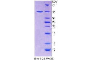 SDS-PAGE analysis of Rat PTHR2 Protein. (PTH2R 蛋白)