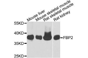 Western blot analysis of extracts of various cell lines, using FBP2 antibody. (FBP2 抗体  (AA 1-339))