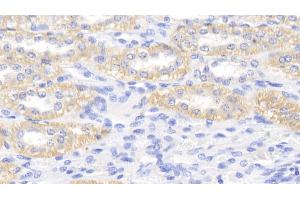 Immunohistochemistry (IHC) image for anti-Apolipoprotein E (APOE) (AA 1-172) antibody (ABIN7440422)