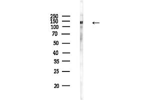 Western blot analysis of lysates from COLO205 cells(heat-shock,45 min treatment), using Phospho-MCM2 (Ser41) Antibody at 1/1000 dilution.