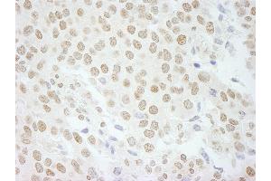 Immunohistochemistry (IHC) image for anti-Pleiotropic Regulator 1 (PLRG1) (AA 464-514) antibody (ABIN7449000) (PLRG1 抗体  (AA 464-514))