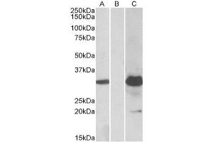 HEK293 lysate (10ug protein in RIPA buffer) overexpressing Human KCTD11 with DYKDDDDK tag probed with ABIN625814 (1. (KCTD11 抗体  (Internal Region))