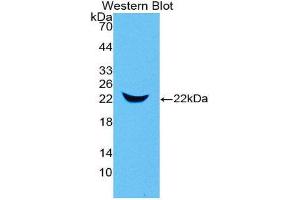 Western Blotting (WB) image for anti-Lipocalin 2 (LCN2) (AA 21-200) antibody (ABIN1078406) (Lipocalin 2 抗体  (AA 21-200))