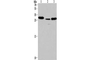 Western Blotting (WB) image for anti-Interleukin-1 Receptor-Associated Kinase 1 Binding Protein 1 (IRAK1BP1) antibody (ABIN5543583) (IRAK1BP1 抗体)