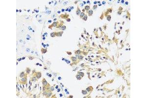 Immunohistochemistry of paraffin-embedded Mouse testis using CALM3 Polyclonal Antibody at dilution of 1:100 (40x lens). (Calmodulin 3 抗体)