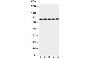 Western blot testing of Ku80 antibody and Lane 1:  Jurkat;  2: CEM;  3: Raji;  4: COLO320;  5: HT1080 cell lysate (XRCC5 抗体  (C-Term))