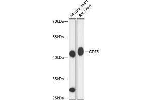Western blot analysis of extracts of various cell lines, using GDF5 antibody (ABIN6133596, ABIN6141044, ABIN6141045 and ABIN6217062) at 1:3000 dilution. (GDF5 抗体  (AA 350-450))