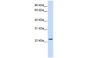 WB Suggested Anti-SCAND2 Antibody Titration: 0. (SCAND2 抗体  (Middle Region))