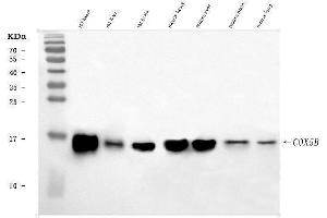Western blot analysis of COX5B using anti-COX5B antibody (ABIN7598975).
