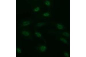 Image no. 4 for anti-CD163 (CD163) antibody (ABIN1497176) (CD163 抗体)
