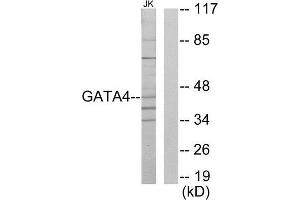 Western Blotting (WB) image for anti-GATA Binding Protein 4 (GATA4) (Internal Region) antibody (ABIN1849369) (GATA4 抗体  (Internal Region))