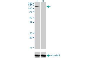 Western blot analysis of RNF111 over-expressed 293 cell line, cotransfected with RNF111 Validated Chimera RNAi (Lane 2) or non-transfected control (Lane 1).