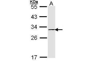 WB Image Sample (30 ug of whole cell lysate) A: A431 , 12% SDS PAGE antibody diluted at 1:1000 (PSMB4 抗体)