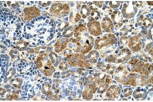 Human kidney (CSTB 抗体  (Middle Region))