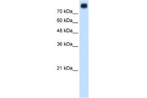 WB Suggested Anti-CDH3 Antibody Titration:  1. (P-Cadherin 抗体  (N-Term))