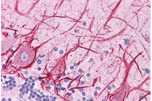 Human Brain, Cerebellum: Formalin-Fixed, Paraffin-Embedded (FFPE) (APOB 抗体  (AA 4031-4080))