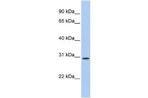 Western Blotting (WB) image for anti-TP53 Target 5 (TP53TG5) antibody (ABIN2459704)