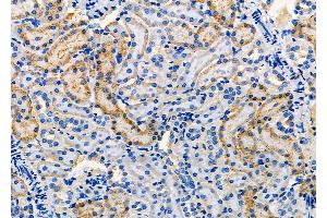 ABIN6260802 and ABIN6277859 at 1/100 staining Rat kidney tissue by IHC-P. (Chromogranin A 抗体  (C-Term))