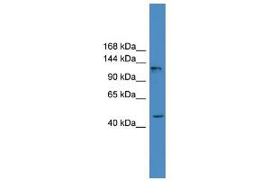 WB Suggested Anti-ADCY2 Antibody Titration:  0.