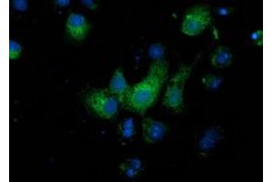 Anti-MGRN1 mouse monoclonal antibody (ABIN2454418) immunofluorescent staining of COS7 cells transiently transfected by pCMV6-ENTRY MGRN1 (RC208284). (Mahogunin RING Finger Protein 1 抗体)