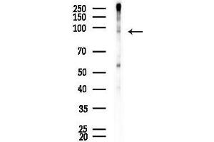 anti-BRCA1 Associated Protein-1 (Ubiquitin Carboxy-terminal Hydrolase) (BAP1) (pSer592) antibody