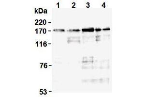 Western Blotting (WB) image for anti-Topoisomerase (DNA) II alpha 170kDa (TOP2A) (N-Term) antibody (ABIN1109282) (Topoisomerase II alpha 抗体  (N-Term))
