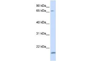 WB Suggested Anti-ZNF398 Antibody Titration:  0. (ZNF398 抗体  (N-Term))