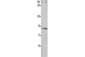 Gel: 8 % SDS-PAGE, Lysate: 40 μg, Lane 1-2: 293T cells, mouse brain tissue, Primary antibody: ABIN7191168(KCNC3 Antibody) at dilution 1/300, Secondary antibody: Goat anti rabbit IgG at 1/8000 dilution, Exposure time: 1 minute (KCNC3 抗体)