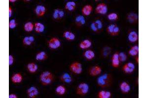 Immunofluorescence (IF) image for anti-Integrin alpha-L (ITGAL) antibody (Alexa Fluor 594) (ABIN2656812) (ITGAL 抗体  (Alexa Fluor 594))