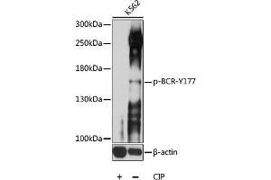 Western blot analysis of extracts of K562 cells, using Phospho-BCR-Y177 antibody (ABIN6135190, ABIN6136026, ABIN6136027 and ABIN6225622) at 1:1000 dilution. (BCR 抗体  (pTyr177))