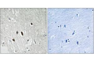 Immunohistochemistry analysis of paraffin-embedded human brain tissue, using RIPK2 (Ab-176) Antibody. (RIPK2 抗体  (AA 146-195))