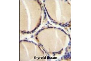 CALCA Antibody (Center) (ABIN655071 and ABIN2844701) immunohistochemistry analysis in formalin fixed and paraffin embedded human thyroid tissue followed by peroxidase conjugation of the secondary antibody and DAB staining. (CGRP 抗体  (AA 56-83))