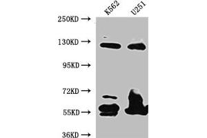 Western Blot Positive WB detected in: K562 whole cell lysate, U-251 whole cell lysate All lanes: BubR1 antibody at 1:1000 Secondary Goat polyclonal to rabbit IgG at 1/50000 dilution Predicted band size: 120, 106, 122 kDa Observed band size: 125 kDa (Recombinant BUB1B 抗体)