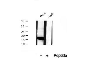 Western blot analysis of extracts of HepG2 cells, using CHCHD2 antibody. (CHCHD2 抗体  (Internal Region))