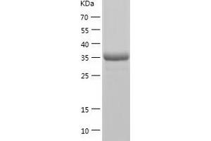 HEXIM1 Protein (AA 1-359) (His tag)