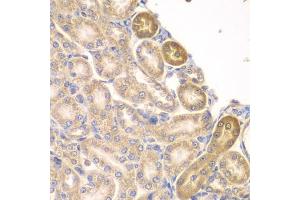 Immunohistochemistry (IHC) image for anti-Phosphatidylinositol-5-Phosphate 4-Kinase, Type II, alpha (PIP4K2A) (AA 120-350) antibody (ABIN6145673)