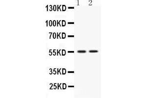 Western blot analysis of VRK1 expression in rat thymus extract ( Lane 1) and JURKAT whole cell lysates ( Lane 2). (VRK1 抗体  (C-Term))