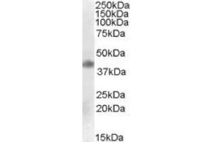 Image no. 1 for anti-Meis Homeobox 1 (MEIS1) (Internal Region) antibody (ABIN375073) (MEIS1 抗体  (Internal Region))