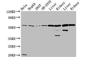 Western Blot Positive WB detected in: Hela whole cell lysate, HepG2 whole cell lysate, 293T whole cell lysate, SH-SY5Y whole cell lysate, Rat liver tissue, Rat kidney tissue, Mouse liver tissue, Mouse kidney tissue All lanes: ALDH7A1 antibody at 4. (ALDH7A1 抗体  (AA 386-515))