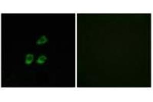 Immunofluorescence analysis of HUVEC cells, using CLCN4 antibody. (CLCN4 抗体)