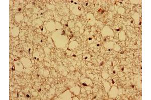 Immunohistochemistry (IHC) image for anti-Copine IV (CPNE4) (AA 1-280) antibody (ABIN7148523)