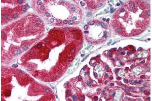 Human Kidney (formalin-fixed, paraffin-embedded) stained with TJP1 antibody ABIN305736 at 5 ug/ml followed by biotinylated goat anti-rabbit IgG secondary antibody ABIN481713, alkaline phosphatase-streptavidin and chromogen. (TJP1 抗体  (AA 463-1109))