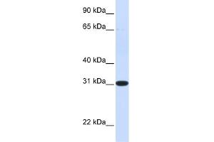 WB Suggested Anti-PBLD Antibody Titration: 0. (PBLD1 抗体  (N-Term))