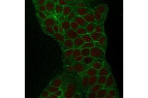 Immunofluorescence (IF) image for anti-Tumor-Associated Calcium Signal Transducer 2 (TACSTD2) (AA 31-274) antibody (ABIN6939972)