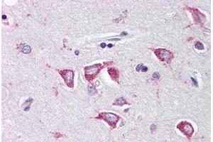 Human Brain, Cortex (formalin-fixed, paraffin-embedded) stained with PCBP4 antibody ABIN214462 at 2. (PCBP4 抗体  (C-Term))