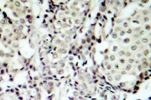 Image no. 1 for anti-Mitogen-Activated Protein Kinase Kinase 3 (MAP2K3) antibody (ABIN265520) (MAP2K3 抗体)
